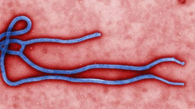 Ebola